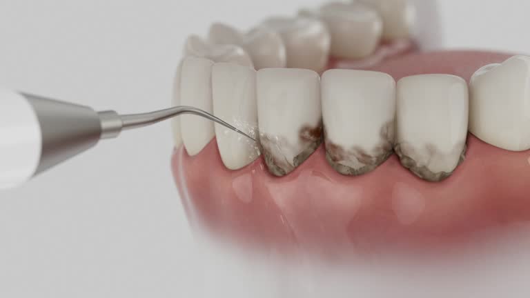 Reliable Wisdom Tooth Removal contractor in Gratiot County County, MI by Dentist Open Now